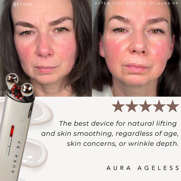 aura rf natural facelifting customer 5 stars review