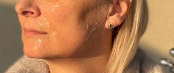 After treatment