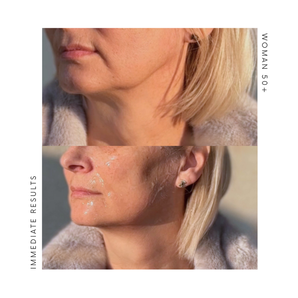 AURA RF lifting massager, collagen booster with RF and LED